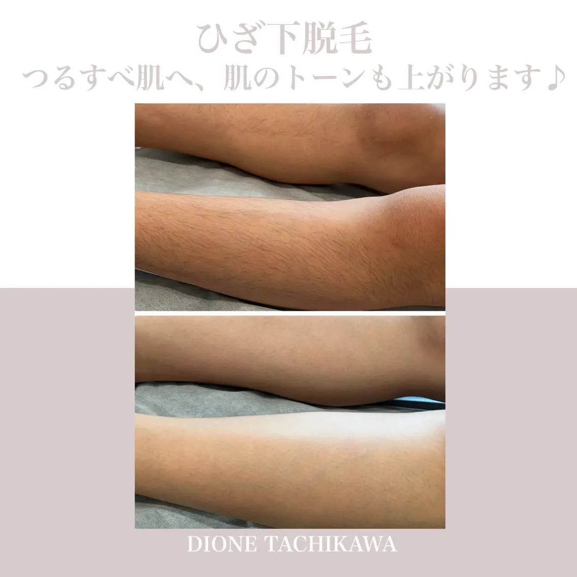 脱毛 Dione 立川店のエステ・リラクイメージ