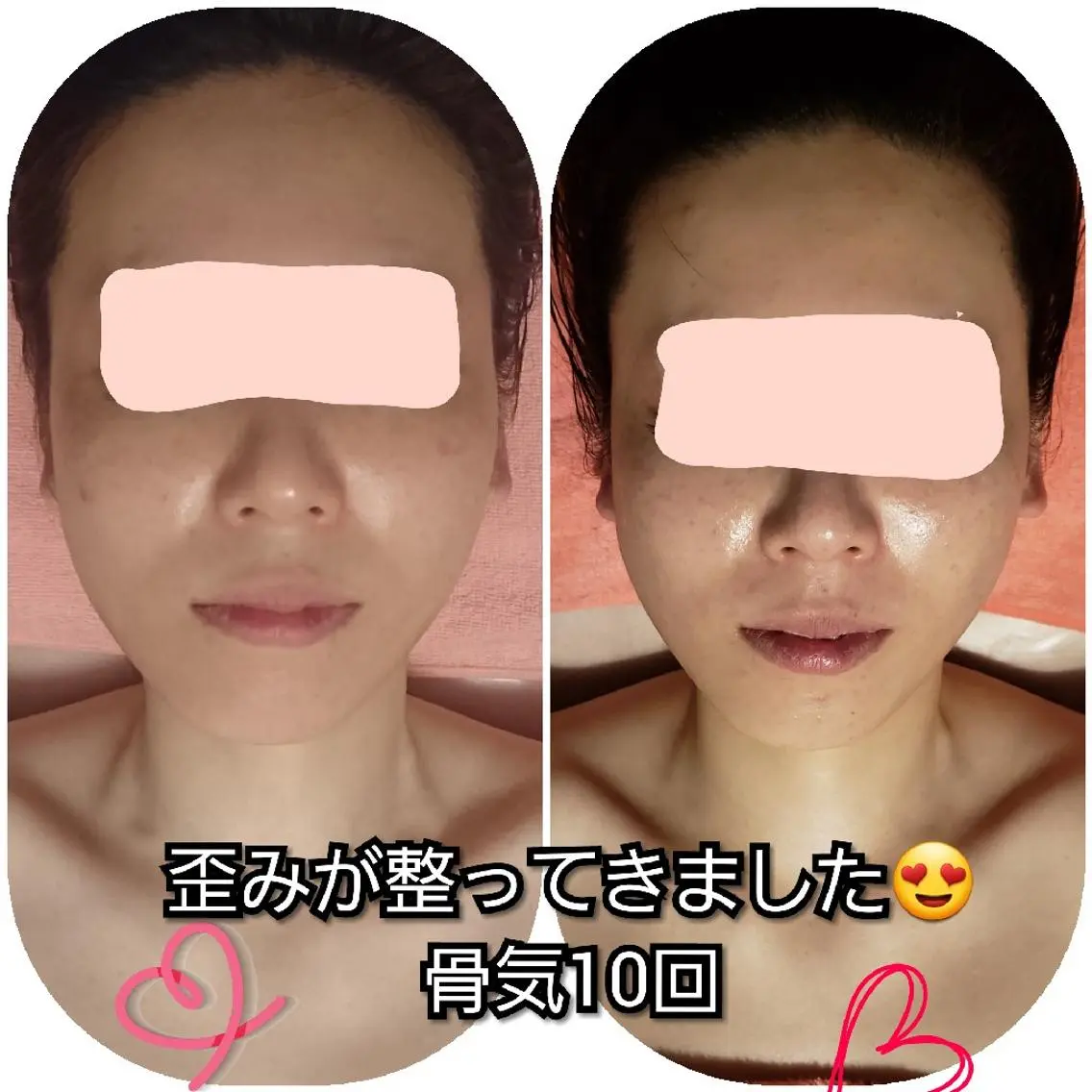 たるみ・ くすみ シミ・ニキビ肌改善のエステ・リラクイメージ