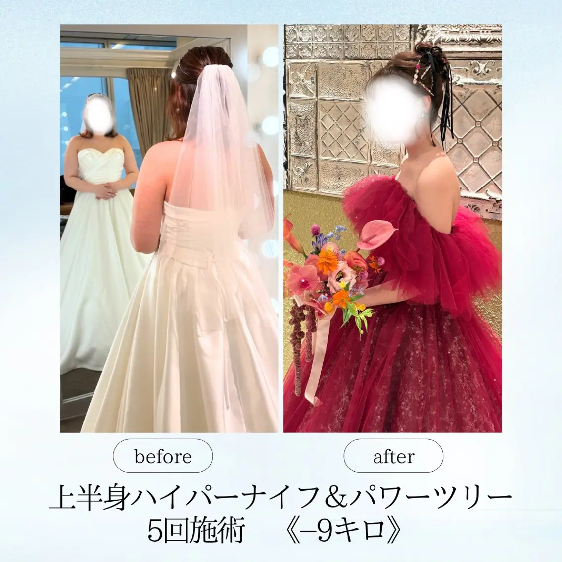 エステ リラク 《痩身、小顔専門店》 エスプレッソのエステ・リラクイメージ