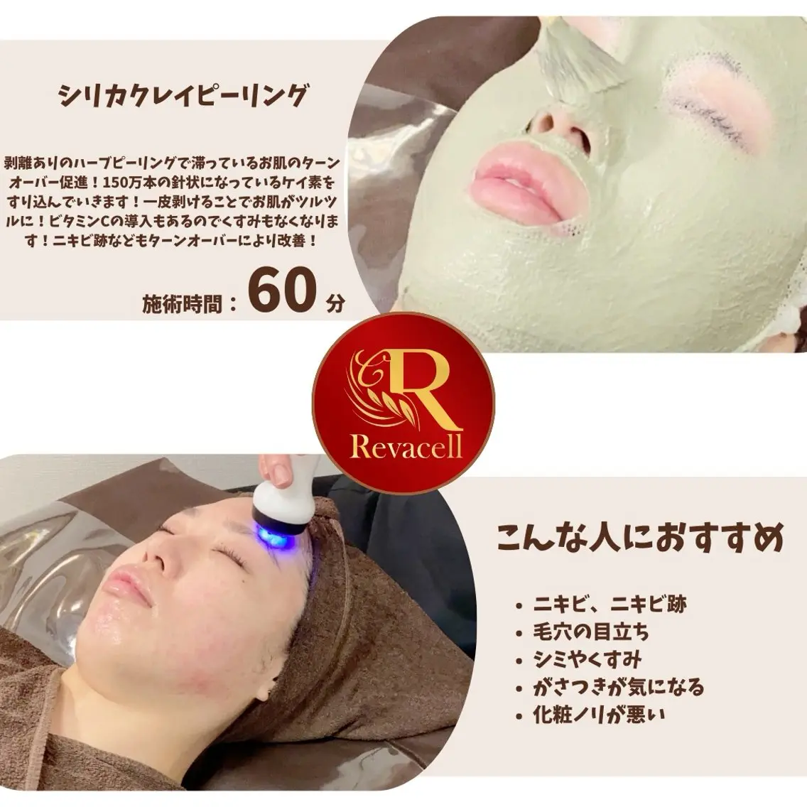 【剥離後ケア付き✨】ハーブピーリング🌿剥離後ケアでお顔のマッサージ、美容液導入でさらにきれいに😍の写真