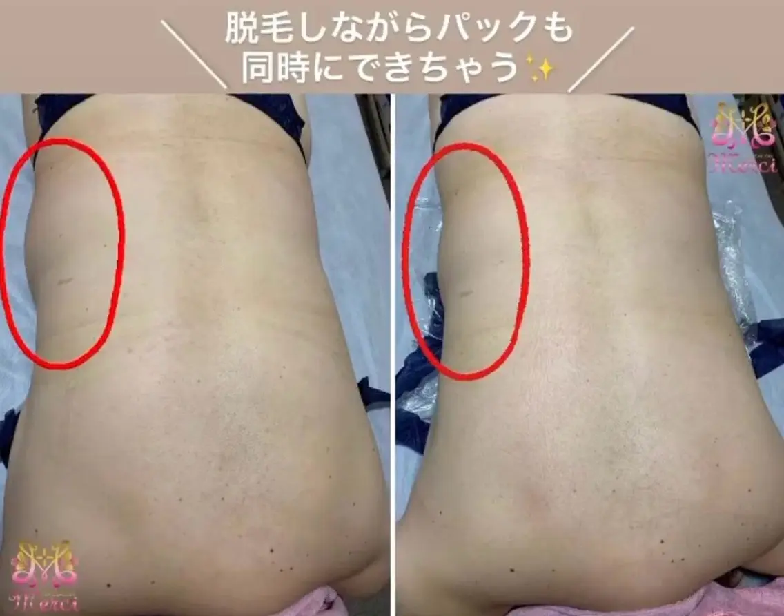 NAILSALON　 Merciのエステ・リラクイメージ