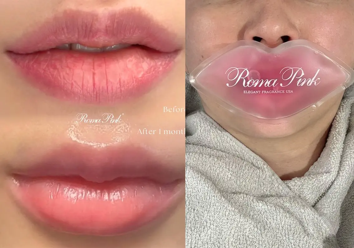 【唇ケア】ローマピンク+アフタークリーム付 通常¥126000→¥99,000の写真