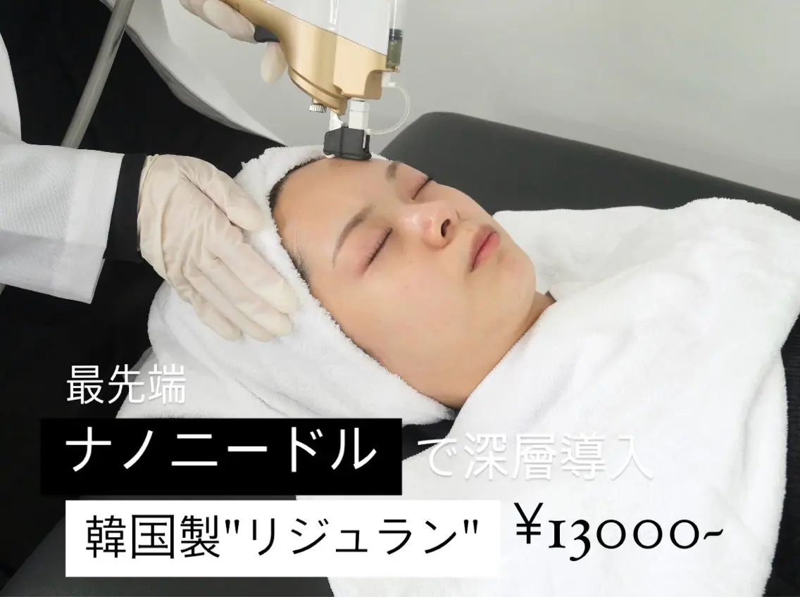 【全ての肌悩みに◎】最先端エステ版ポテンツァ!毛穴/お肌の凹凸/トラブル肌/エイジングケア/長年の赤みに対応の写真