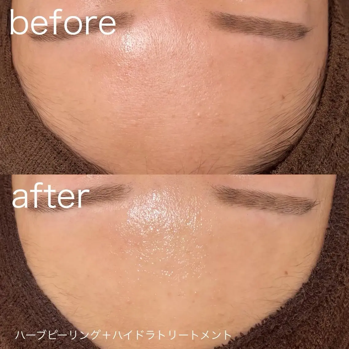 脱毛 lulularico Yuのネイルデザイン