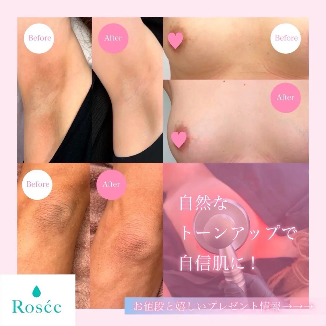 Rosée南青山 ビューティーサロンのエステ・リラクイメージ
