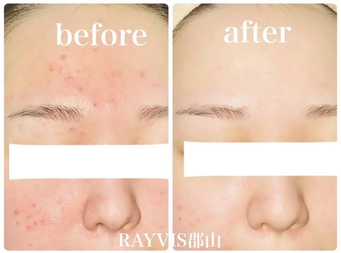 RAYVIS 郡山店 小野のエステ・リラクイメージ