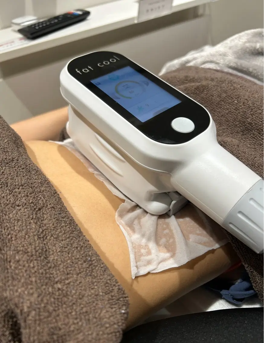 【脂肪痩身お試し】 お腹1カップ 25分間冷却!の写真