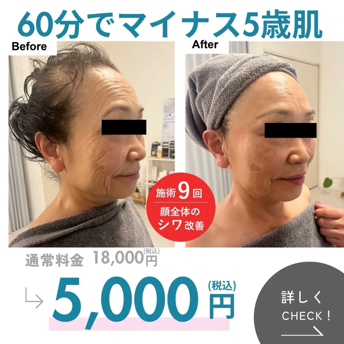 60分で-5歳肌✨エイジングケア🌸デコルテマッサージ付きの写真