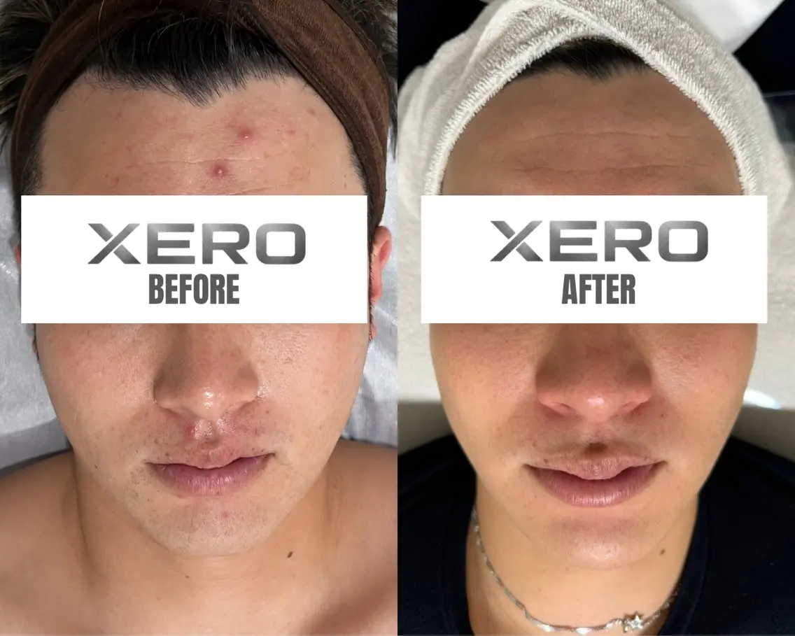 メンズ エステ メンズ特化肌質改善 XEROのエステ・リラクイメージ