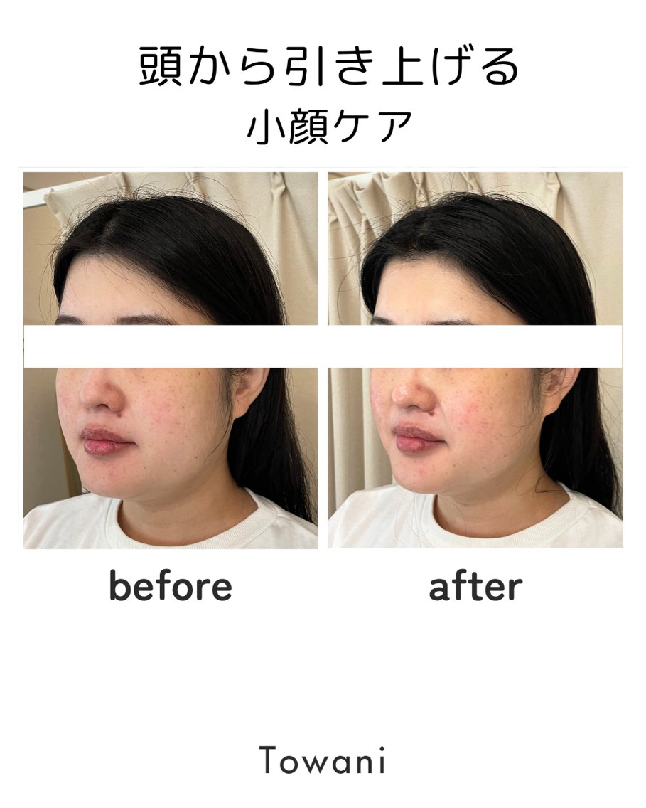 Towani 小顔・ビタミンケアのエステ・リラクイメージ