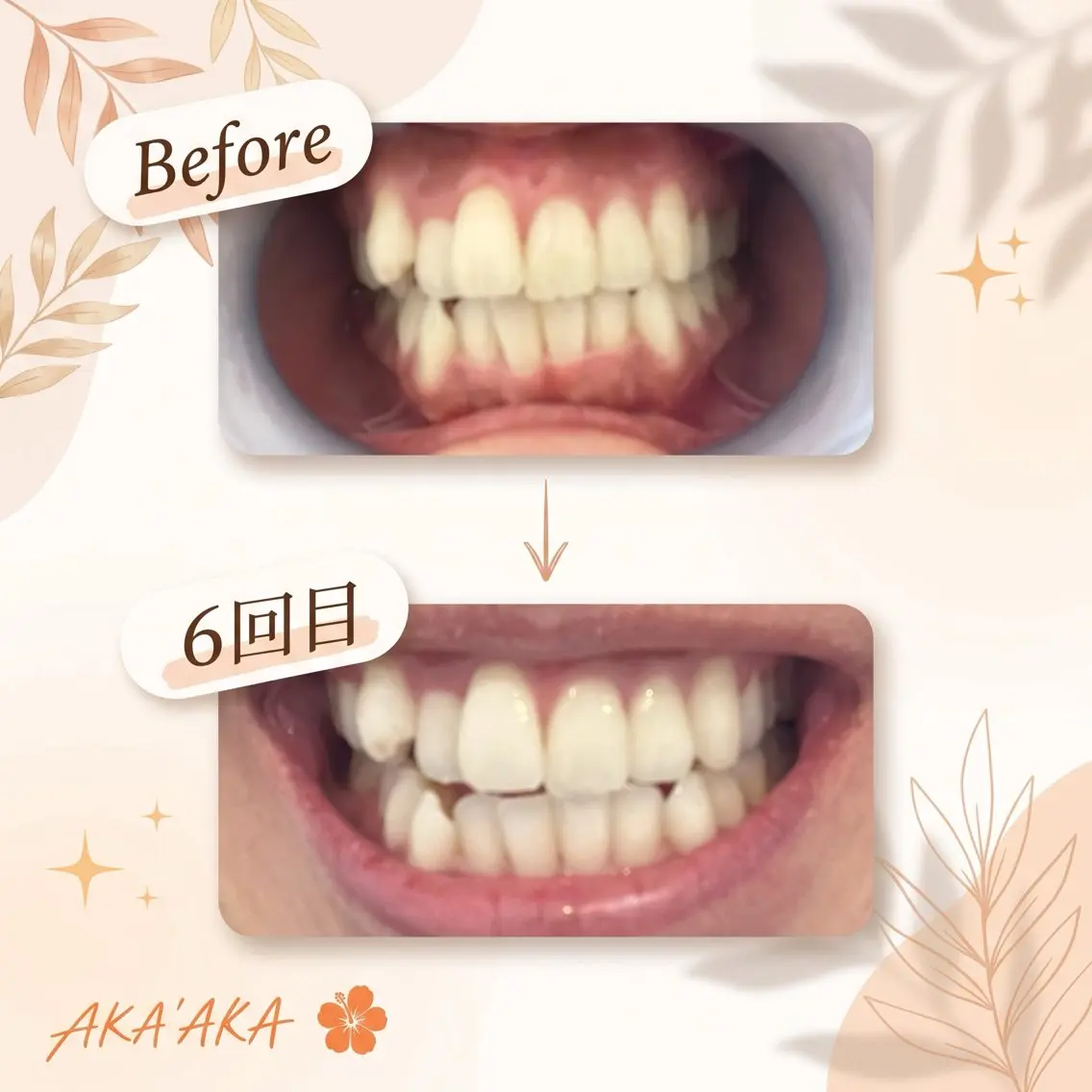 【学割U22】の写真