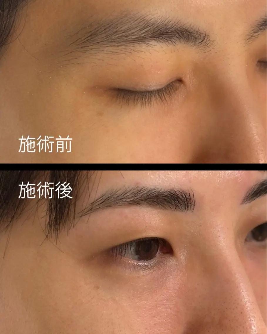 メンズ アイブロウ メンズ就活ヘア ワックス脱毛 眉カット その他(アイブロウ) メンズ眉毛サロン マユクリア沖縄那覇店のエステ・リラクイメージ