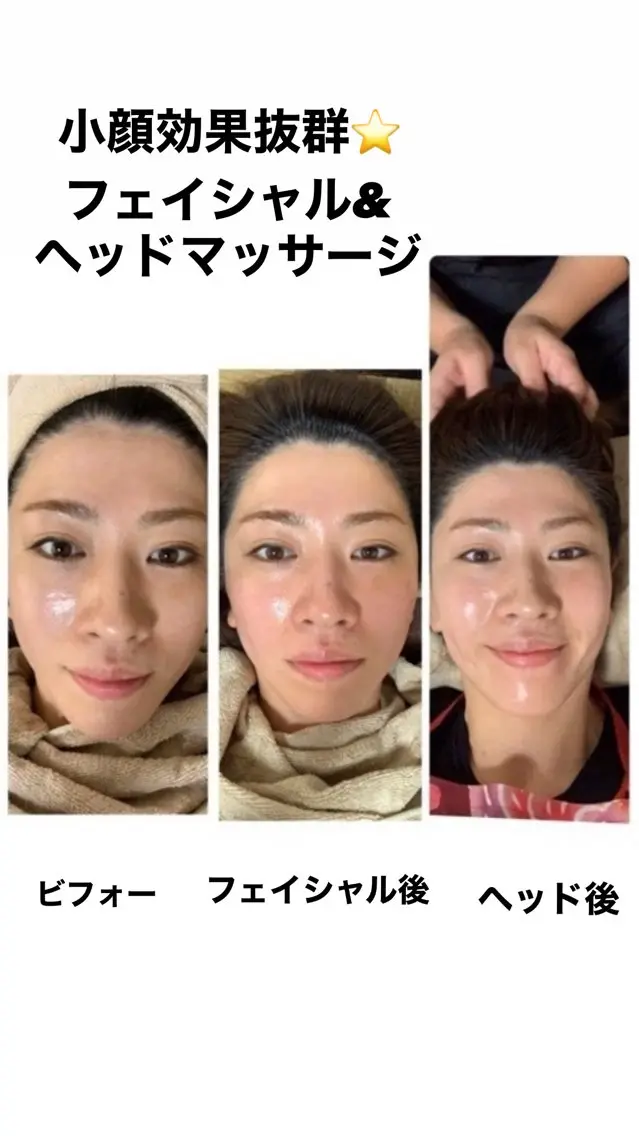 【お顔がぐんぐん上がります⭐️小顔効果抜群⭐️】小顔フェイシャル＋ヘッドマッサージ+EMS+光フォトの写真