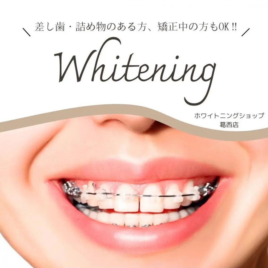 メンズ その他 ホワイトニング ショップ葛西店のその他イメージ