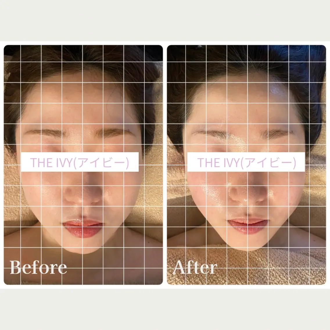 深くリラックスしたい方へ🌿\ドライヘッドスパ×小顔ケア/+上半身オイルリンパ付き(65分)の写真
