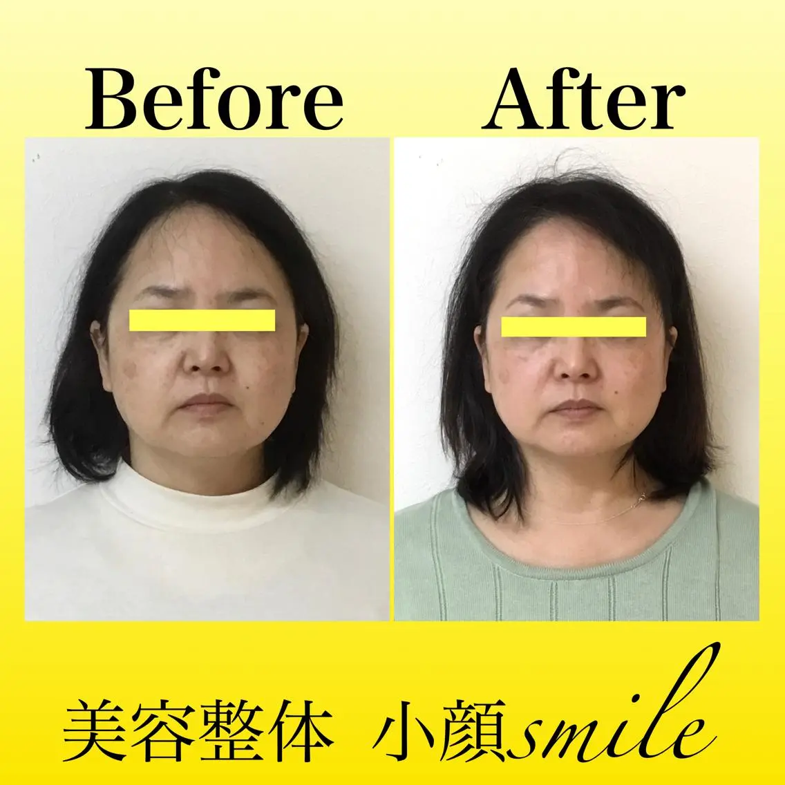 エステ リラク 【小顔・姿勢矯正】 美容整体 SMILEのエステ・リラクイメージ
