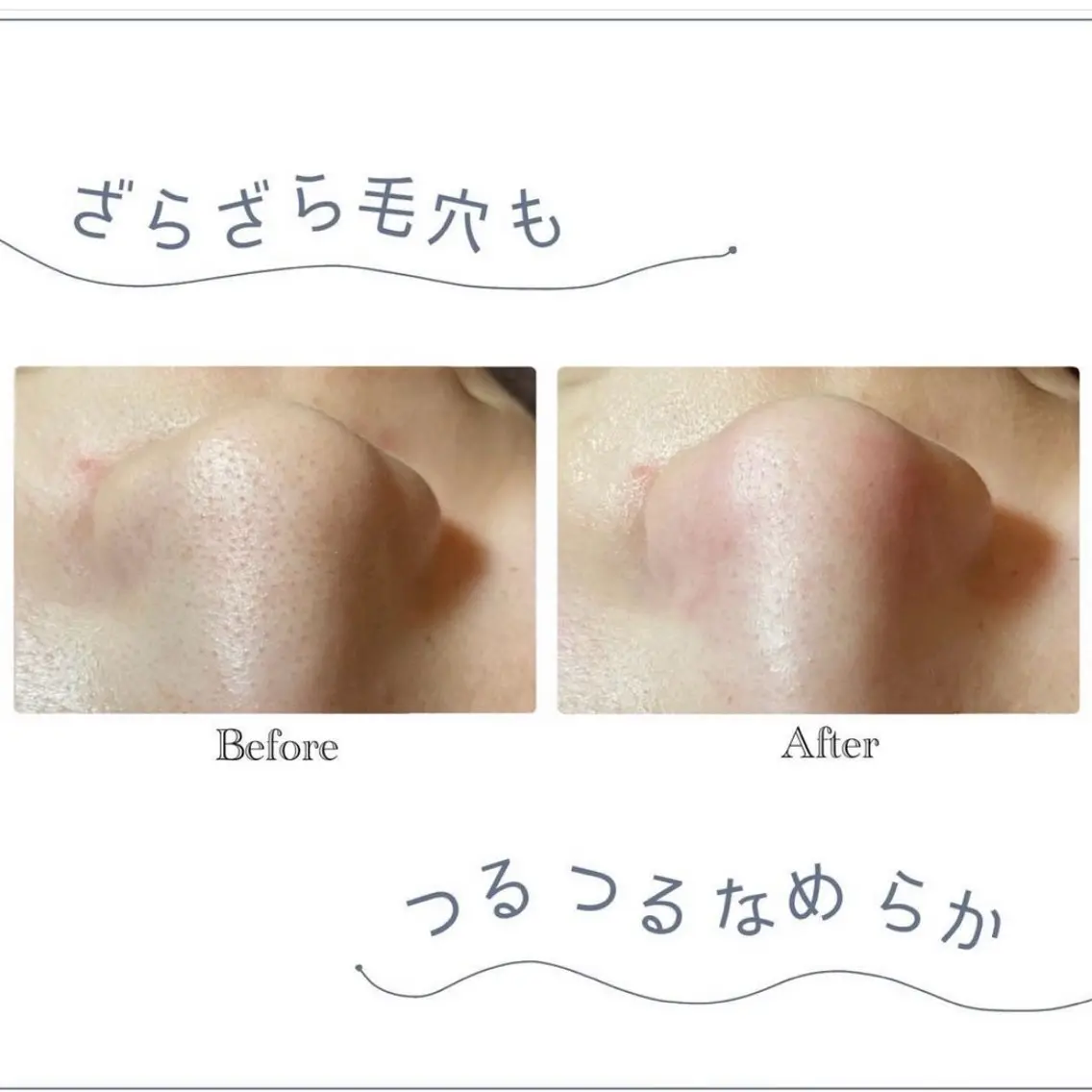 韓国肌管理 白玉肌管理®︎のエステ・リラクイメージ