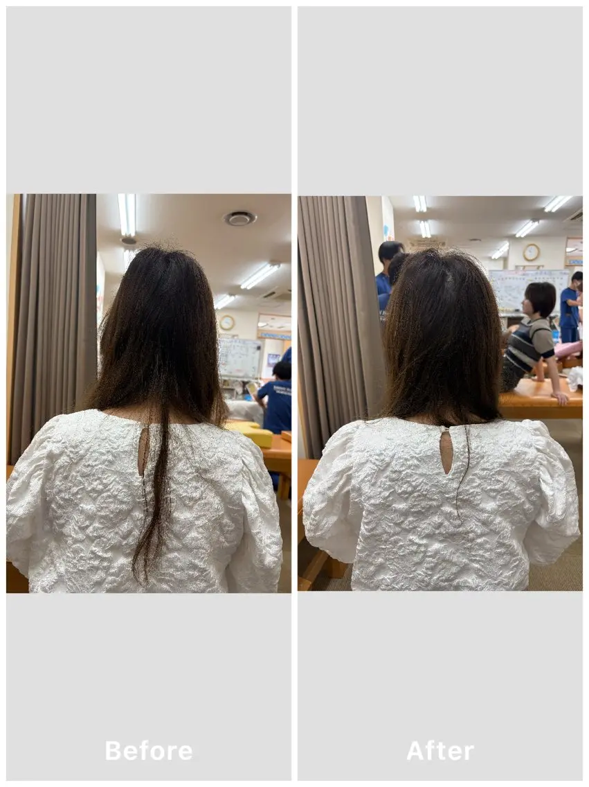美容鍼×小顔矯正× 美容整体/小林幸司のエステ・リラクイメージ