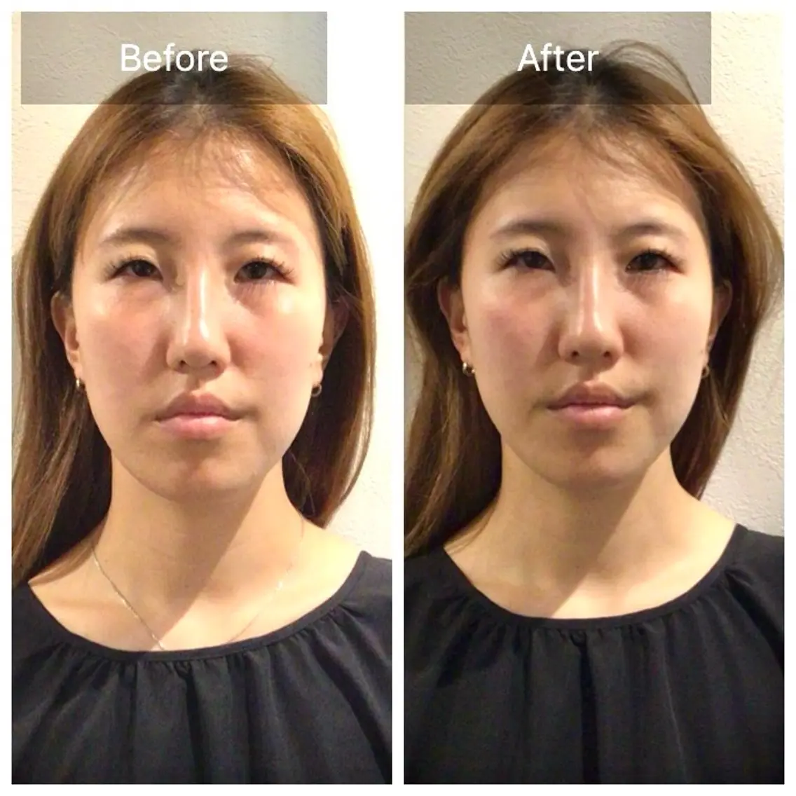 小顔輪郭整体💆‍♀️の写真
