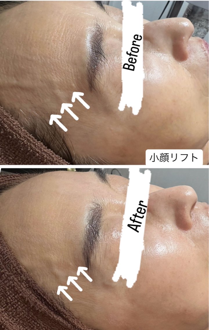 エステ 桐山 まどかのエステ・リラクイメージ