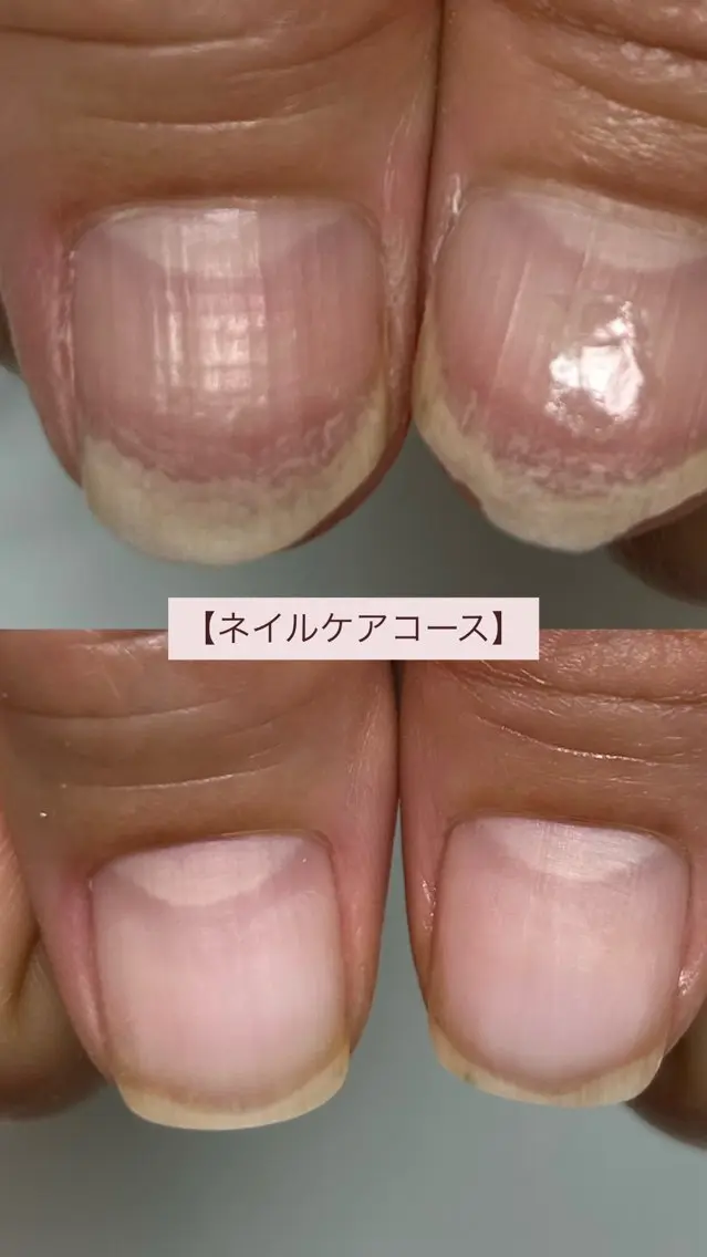 贅沢✴︎プレミアムハンドケアの写真