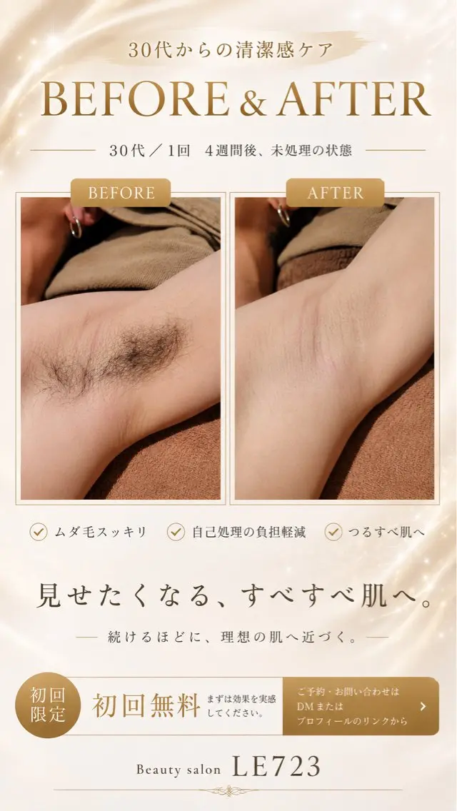 脱毛 LE 723のエステ・リラクイメージ