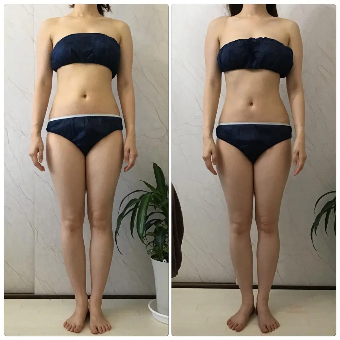 全身痩せたい方用!全身バランス調整ダイエット☆おまかせコース!(フェイシャルは含まない)の写真