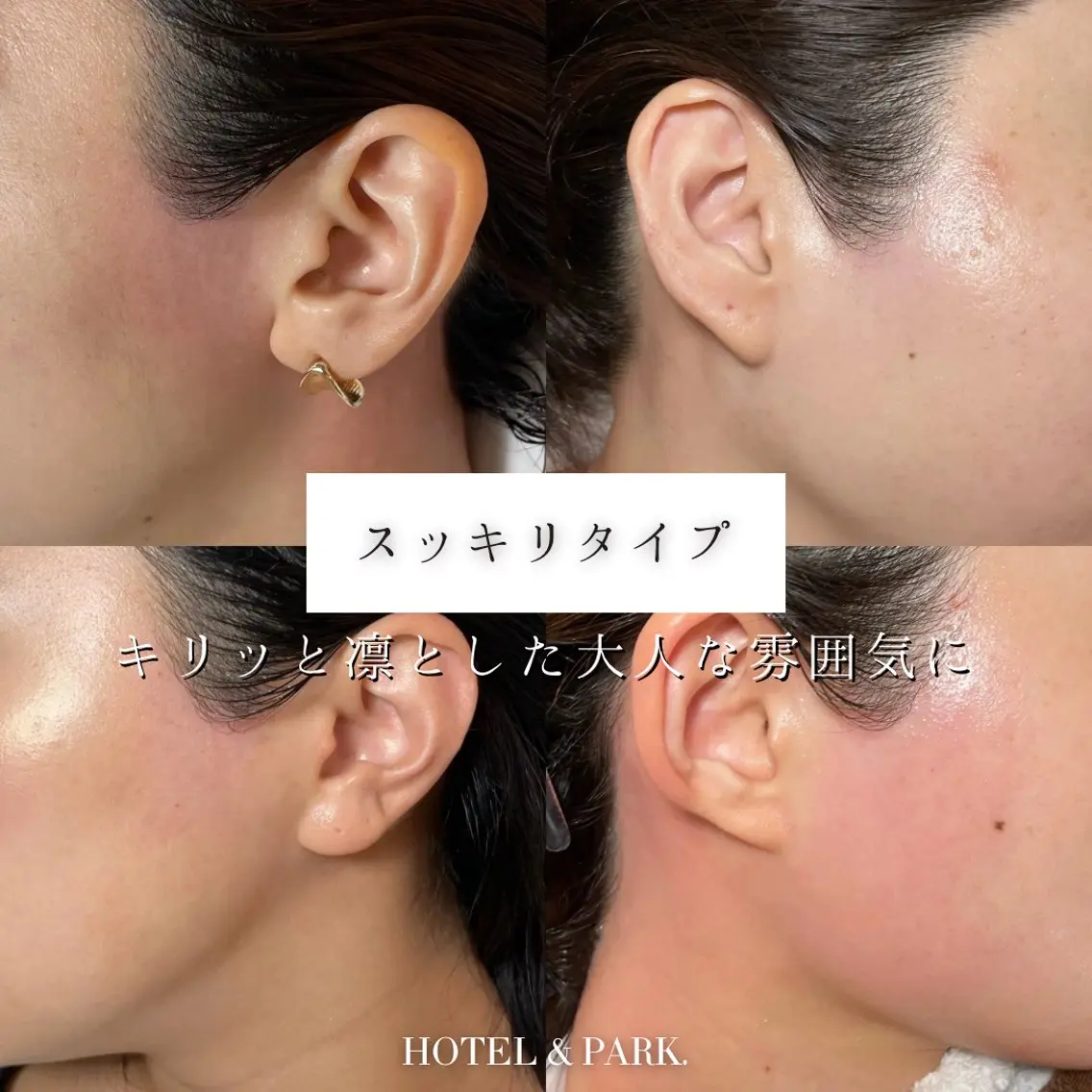 脱毛 HOTEL&PARK . ワックス脱毛のエステ・リラクイメージ