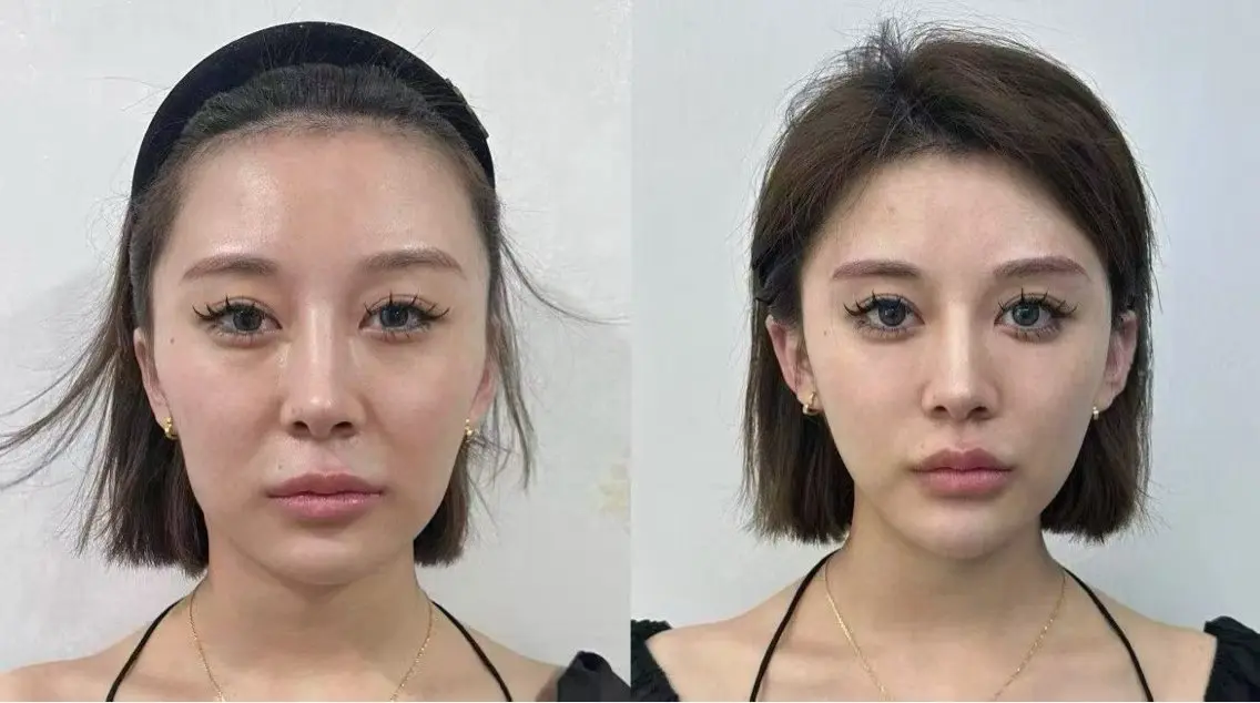 ネイル エステ 愛維美水光専門店 川崎彩鳳のエステ・リラクイメージ