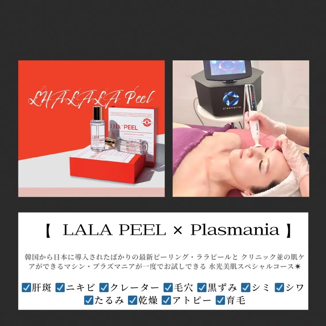 エステ Bevi salonのその他イメージ