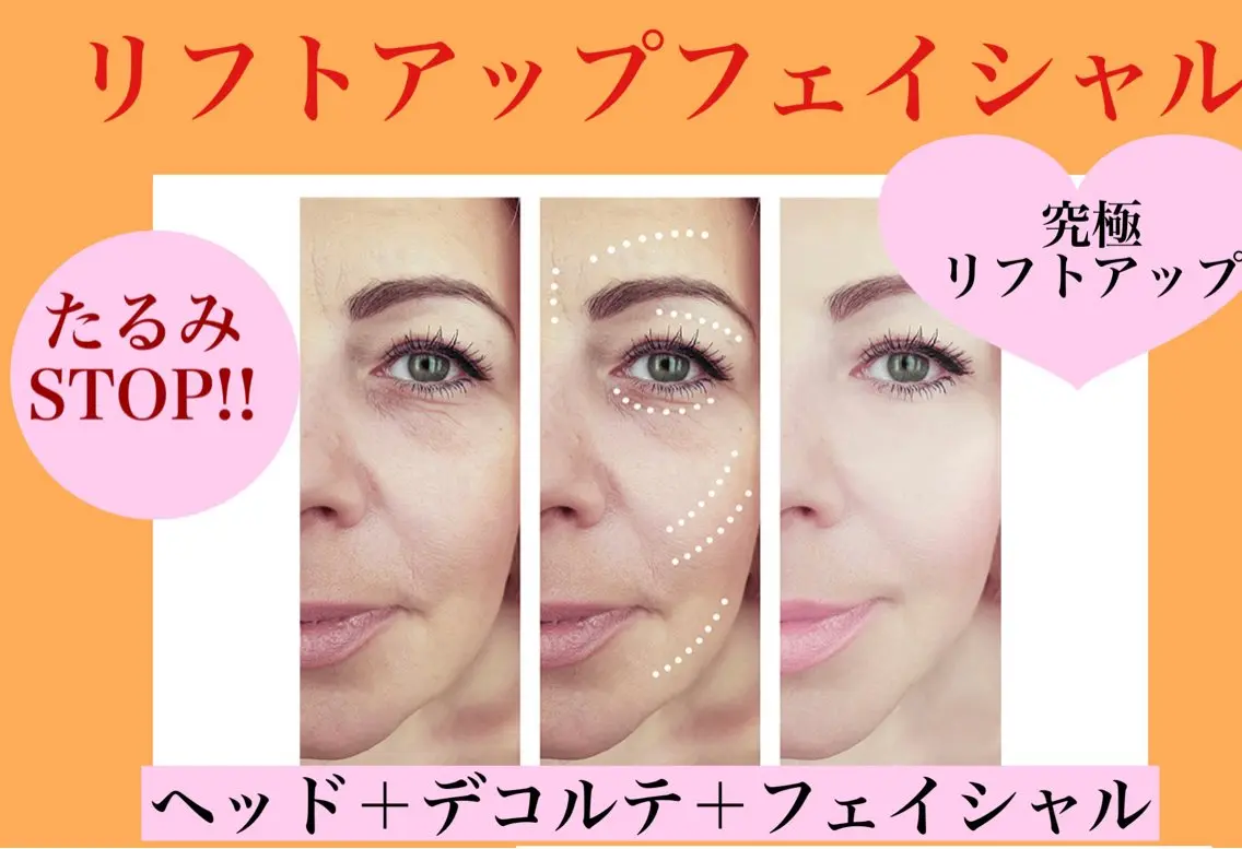 リフトアップエステの写真