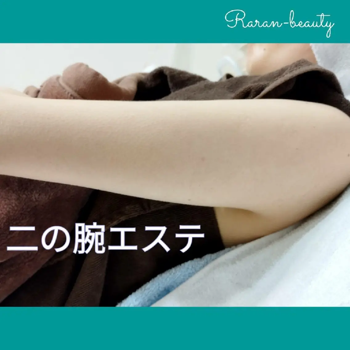 💐花嫁様🎉【二の腕ブライダルエステ(炭酸引き締め二の腕ケア)】＆無料相談コースの写真