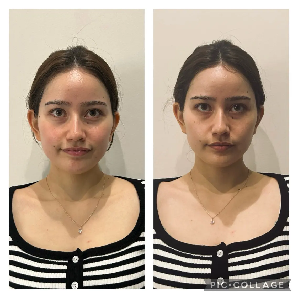 体質改善サロン Fleuretteのエステ・リラクイメージ