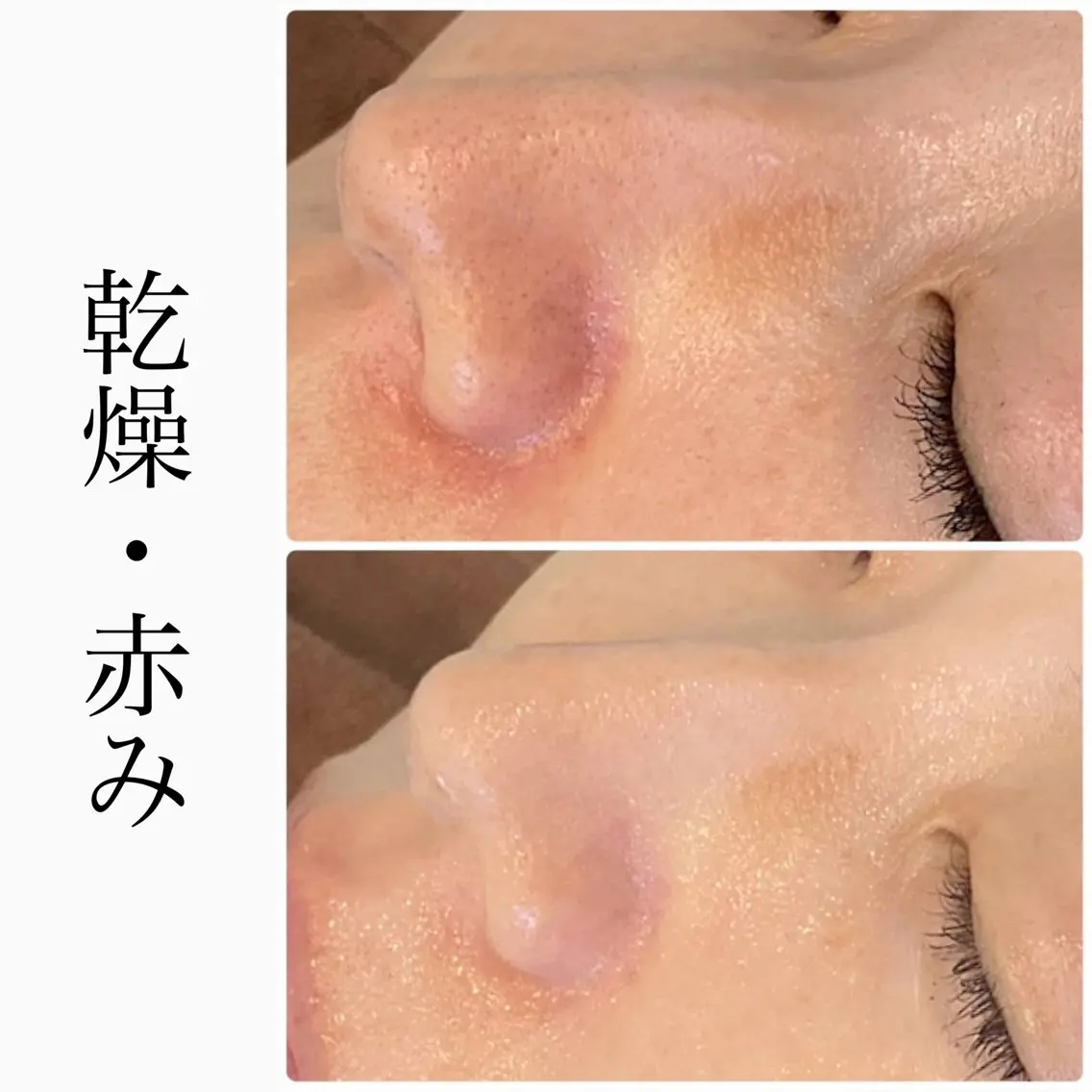 エステ ハーブピーリング専門 BIOEL横浜のエステ・リラクイメージ