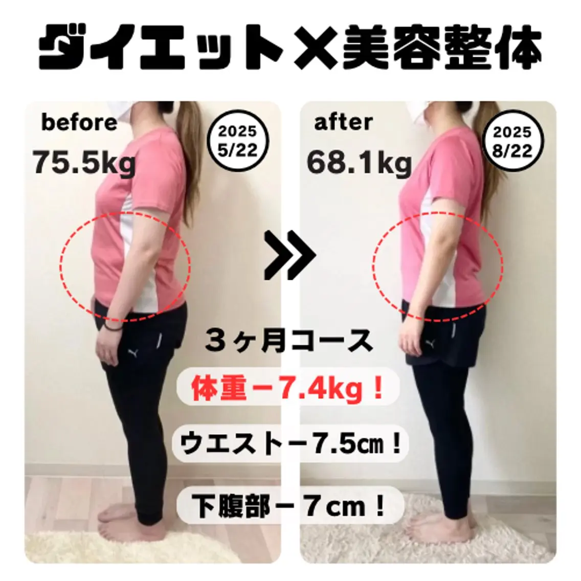 【今60kgで5kg以上痩せたい方限定】ヴレ式ダイエット×痩身整体カウンセリングの写真