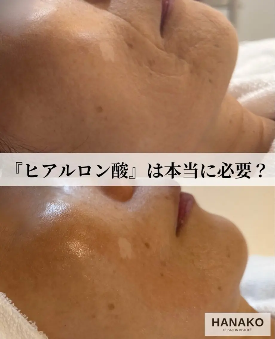 HANAKO 山下のエステ・リラクイメージ