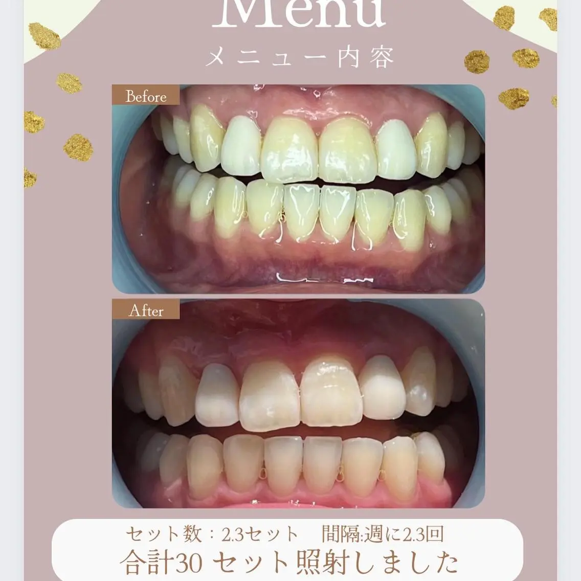 LAVISH 大和店 emi･:*+のネイルデザイン