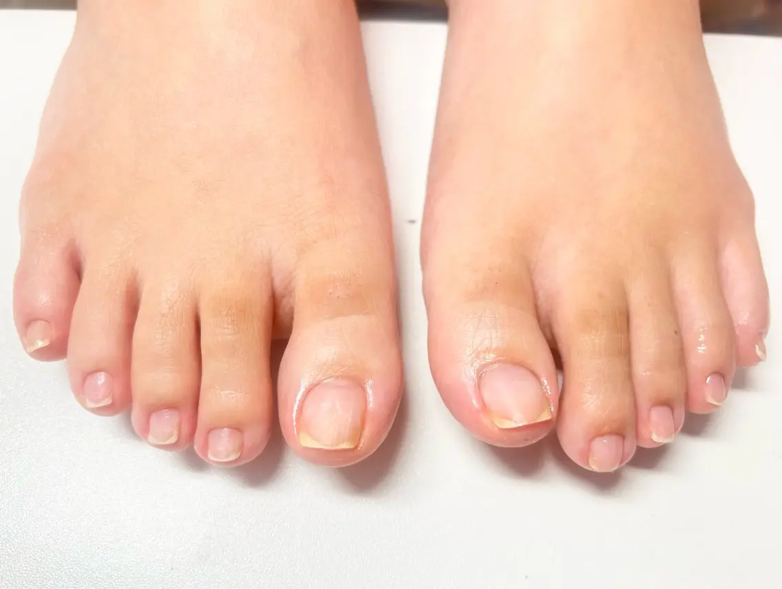 ネイル フットネイル HOMEY NailStudioのネイルデザイン