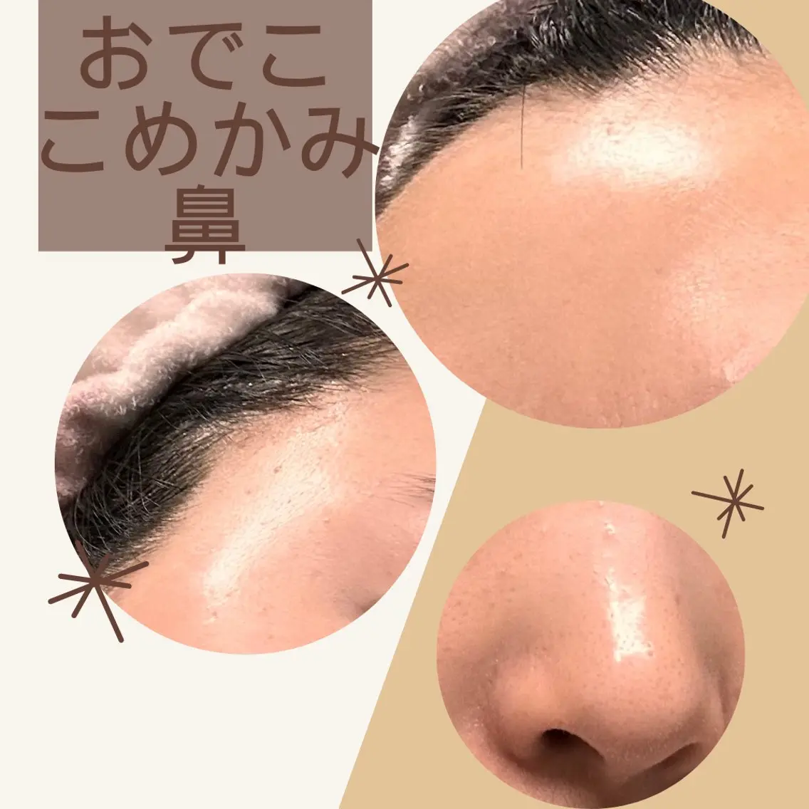 ハーブリプロの写真