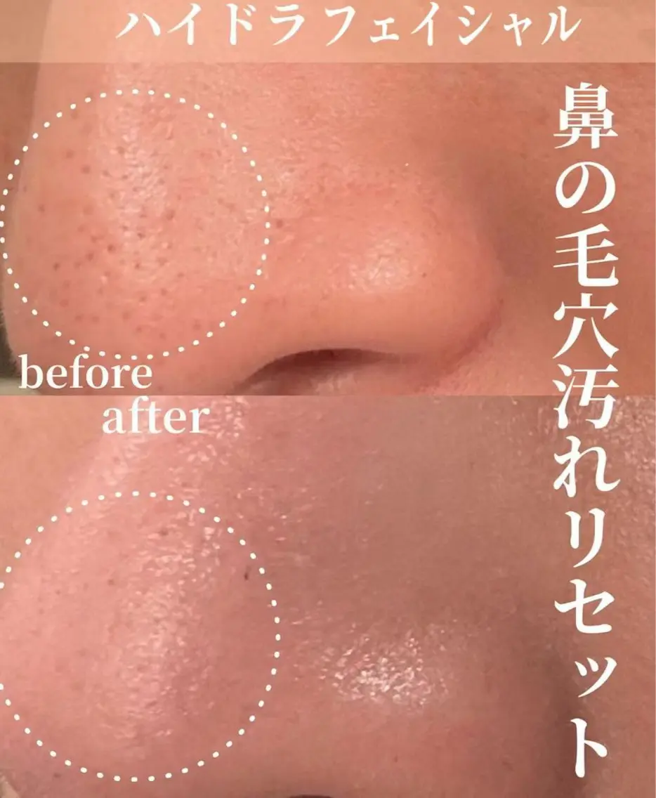 赤羽Stars beautyのエステ・リラクイメージ