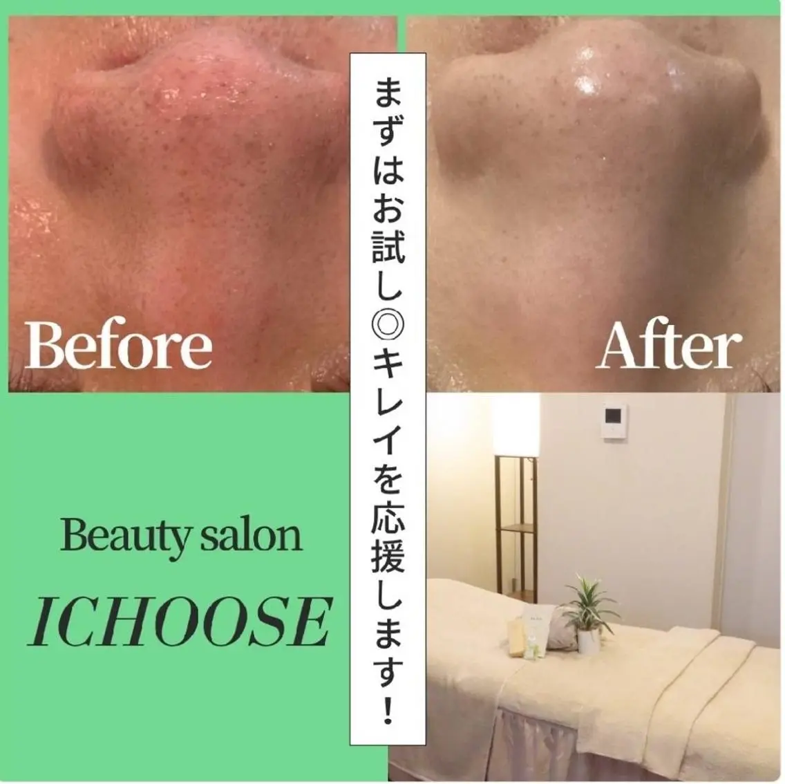 【毛穴黒ずみ/開き】ハーブピーリング/導入/モデリングマスク✨の写真
