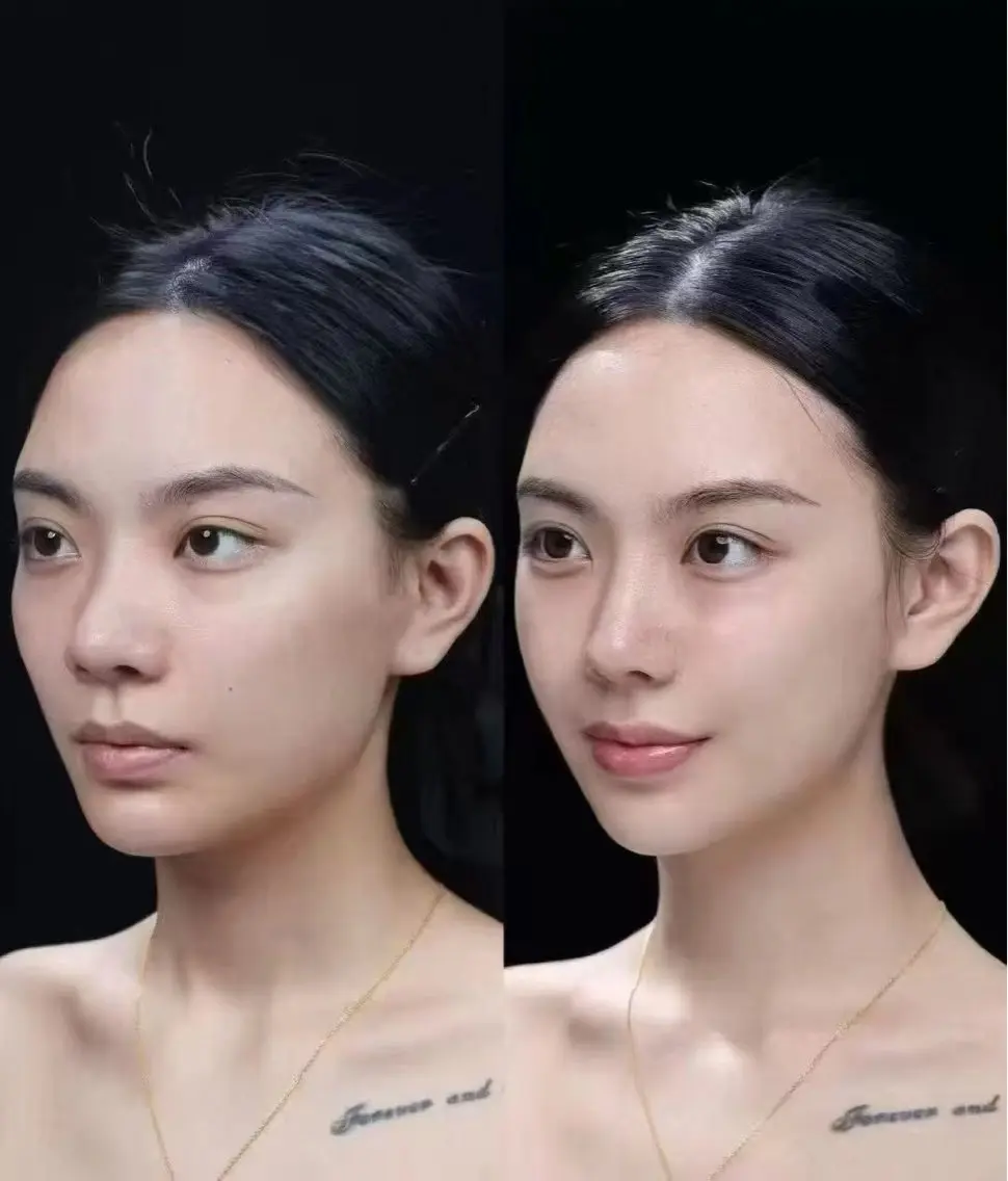 ネイル aliaハーブ水光店 エステティシャン募集のエステ・リラクイメージ