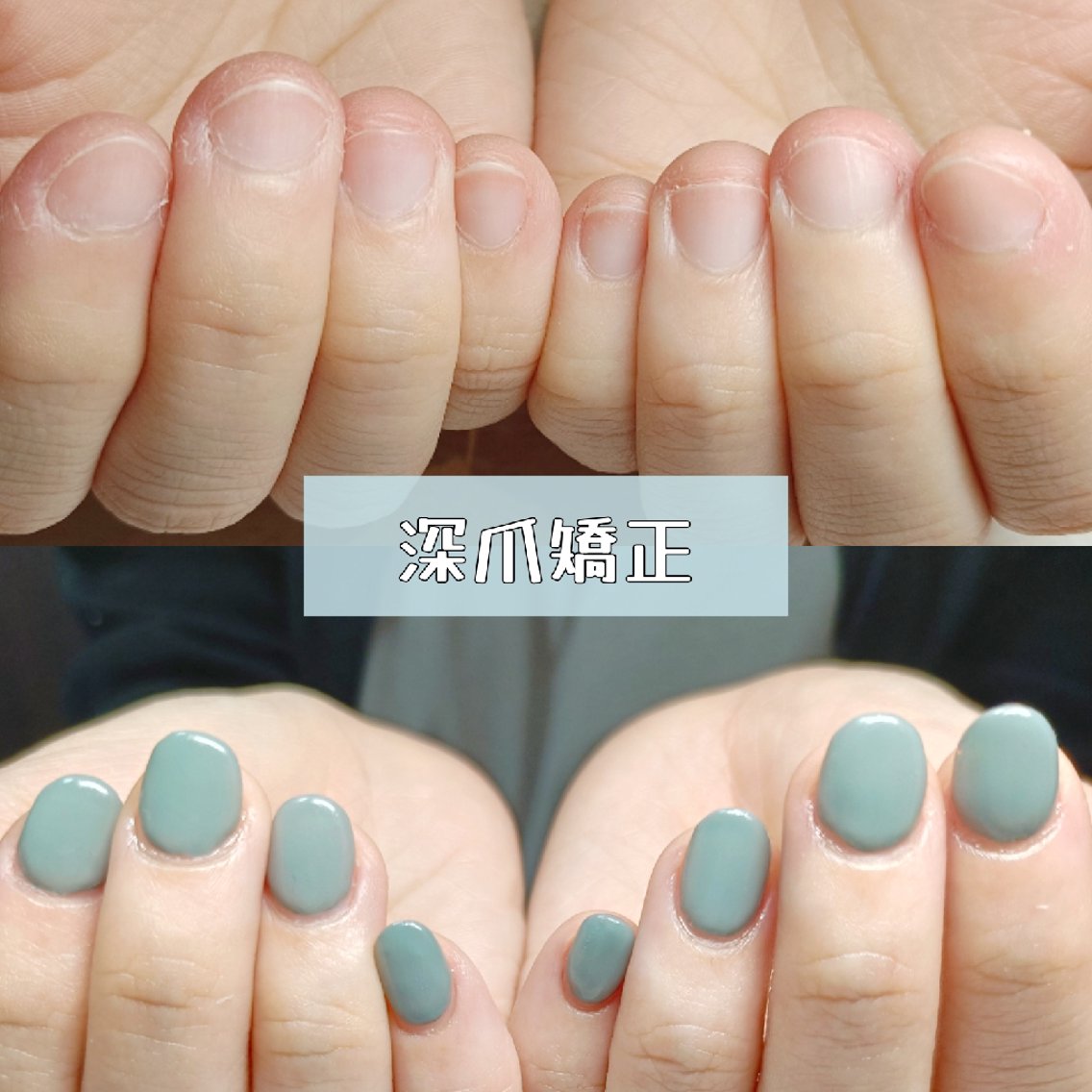 ネイル 長さ出し スカルプネイル ハンドネイル ハンドケア 深爪矯正/爪育成ケア manie nailのネイルデザイン