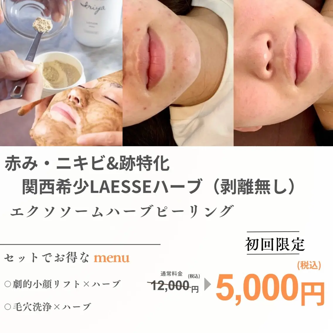 エステ 最速小顔・肌質管理 espoirマキのエステ・リラクイメージ