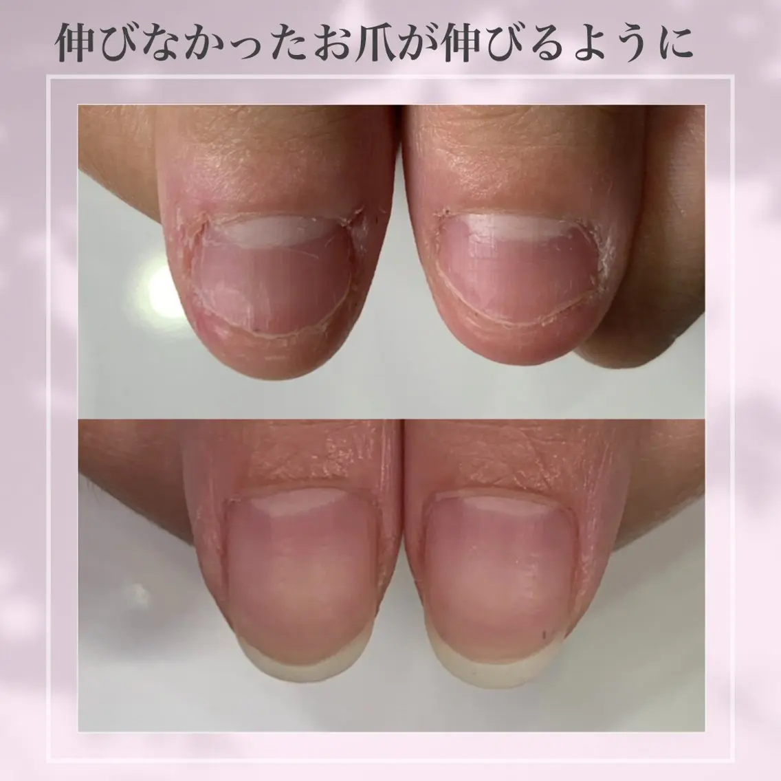ネイル ジェルネイル 雀宮 自爪育成 Re.nail〜寺本のネイルデザイン