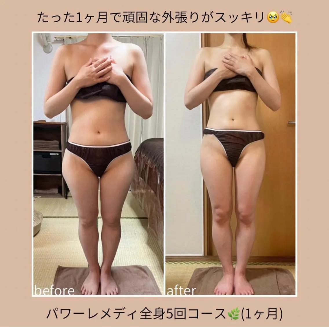 《本気痩せ×疲労改善 》 BILOOPのエステ・リラクイメージ