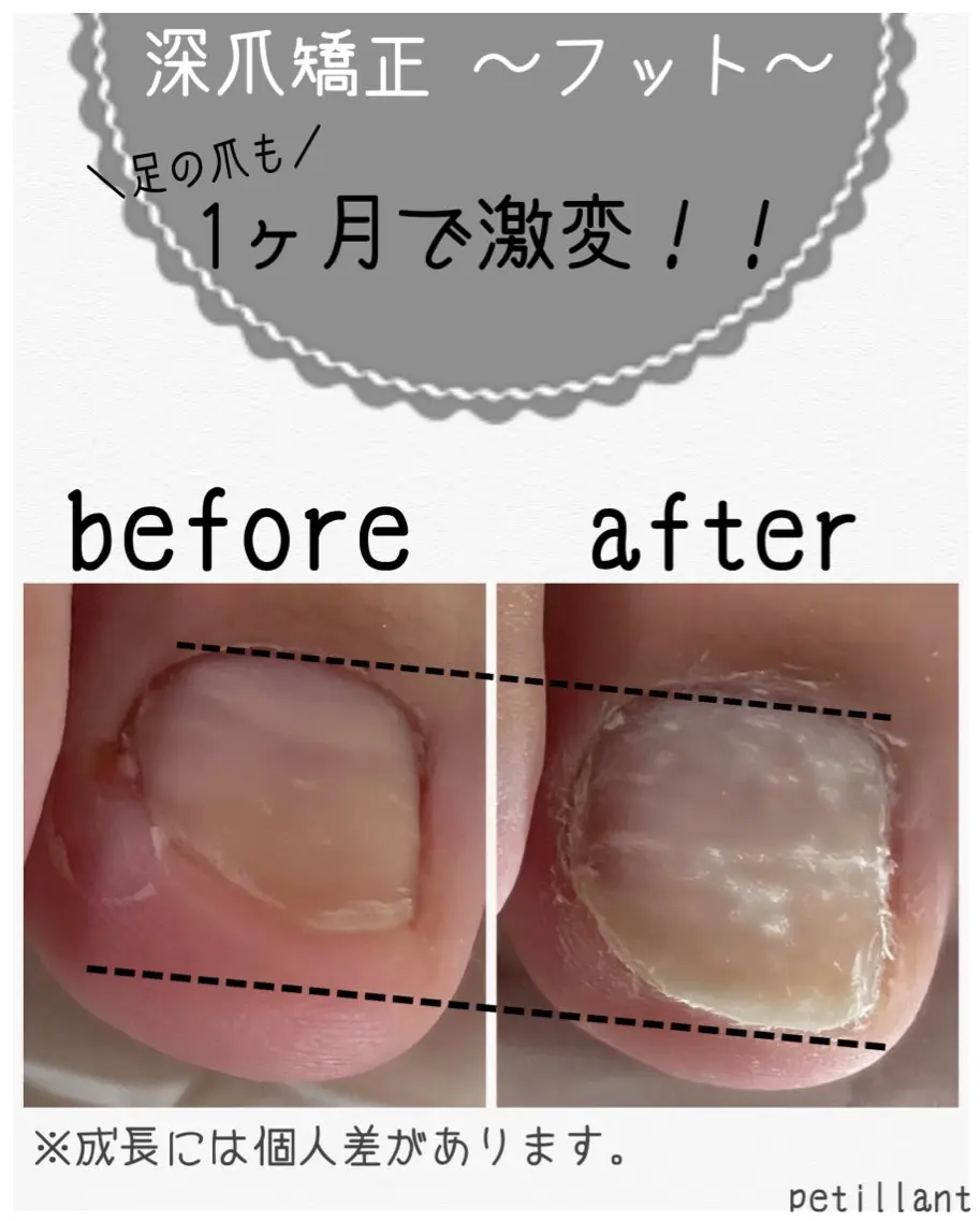 ネイル フットネイル ジェルネイル nail salon petillantのネイルデザイン