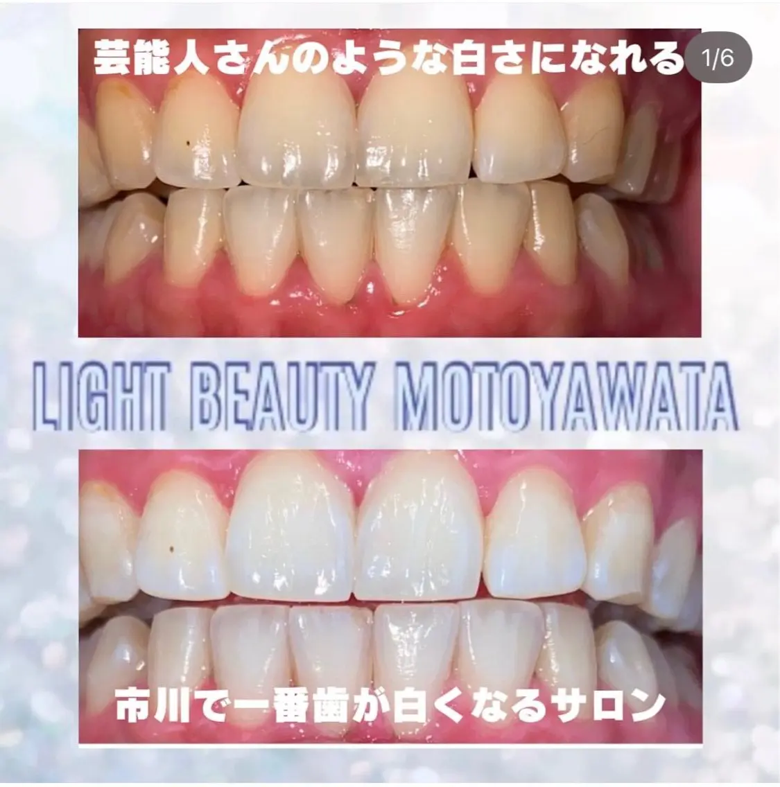 五十嵐 蓮のその他イメージ