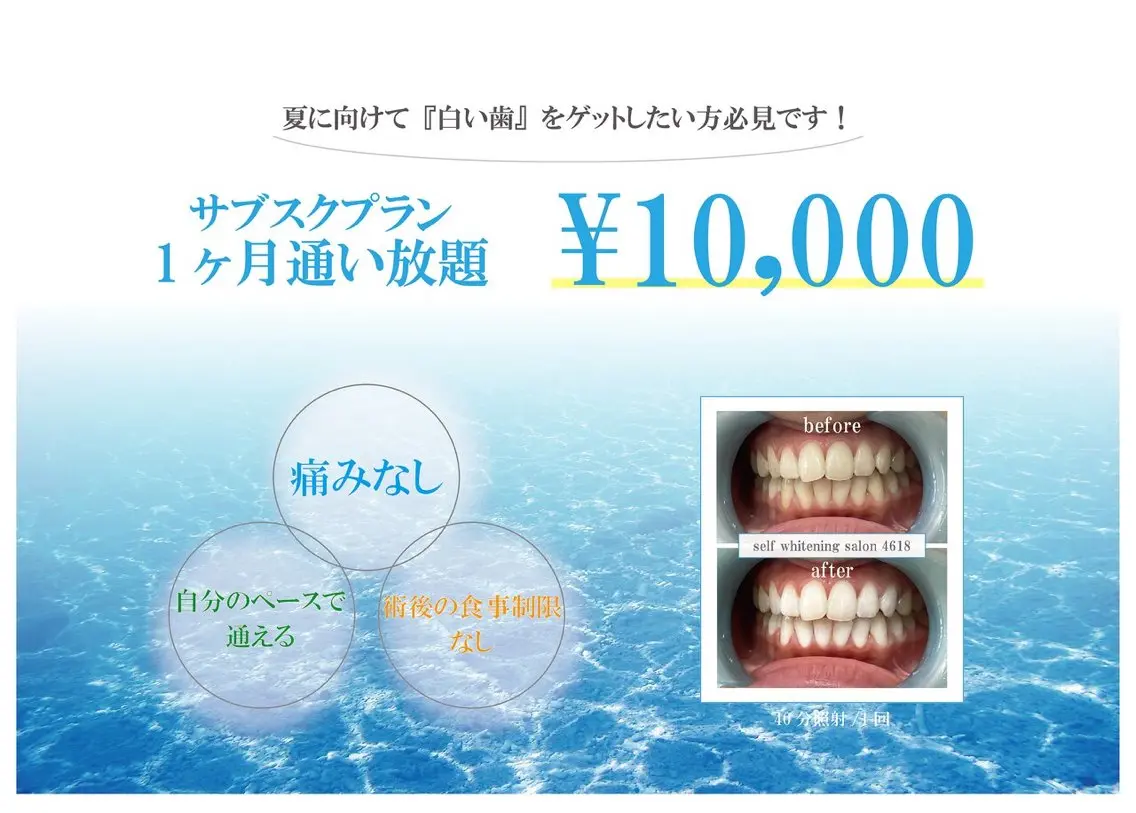 【ホワイトニング】サブスクプラン 1ヶ月通い放題 ¥10,000の写真