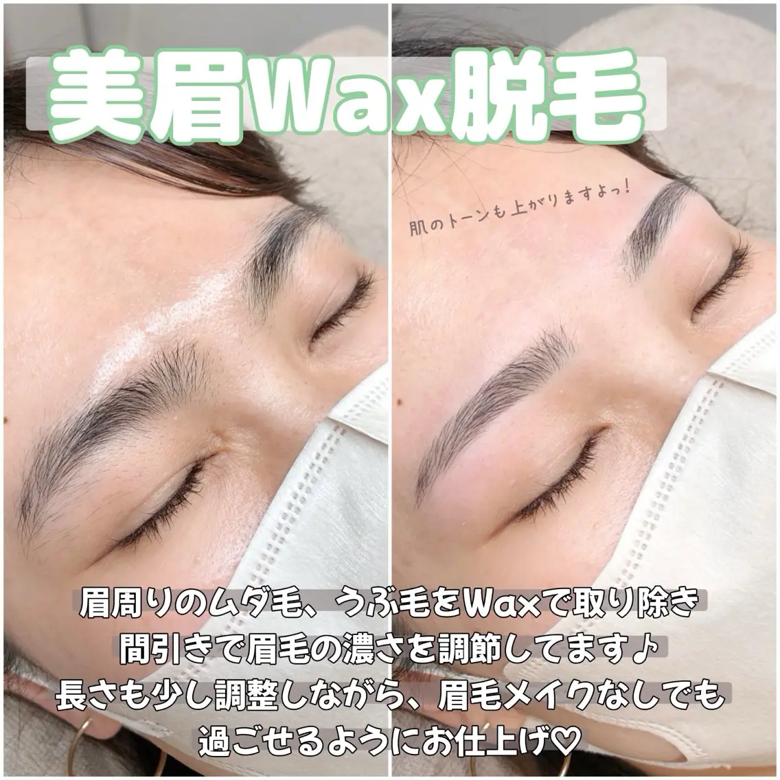 美眉WAX脱毛の写真